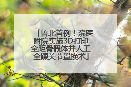 鲁北首例！滨医附院实施3D打印全距骨假体并人工全踝关节置换术